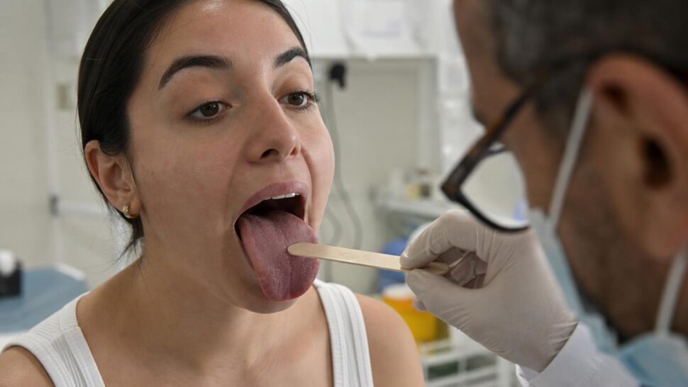 Lo que el color de tu lengua dice sobre tu salud según los médicos