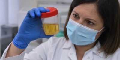 Lo que el color de tu orina dice sobre tu salud según los médicos