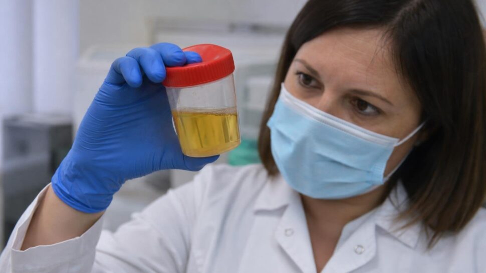 Lo que el color de tu orina dice sobre tu salud según los médicos