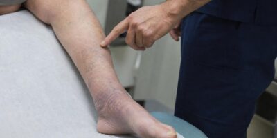Lo que tus pies dicen sobre tu circulación según los médicos