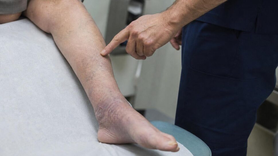 Lo que tus pies dicen sobre tu circulación según los médicos
