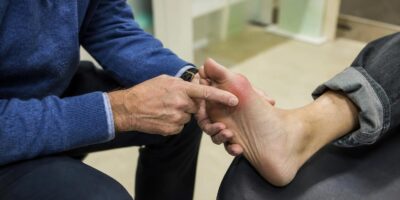 Los médicos explican la gota: por qué aparece y qué la dispara