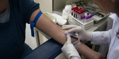 Qué significa de verdad tu nivel de glucosa en ayunas en el análisis de sangre