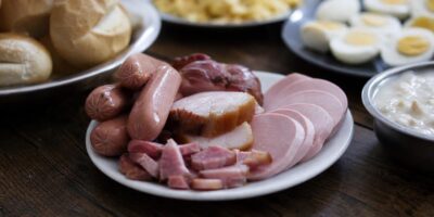 El alimento número 1 que empeora las varices según los médicos