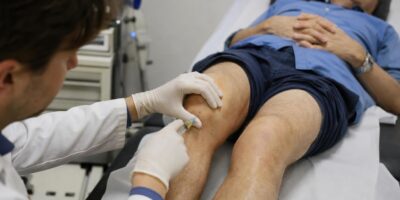 El avance contra la artrosis de rodilla que ya se prueba en pacientes y que podría retrasar la prótesis