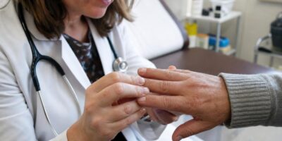 La señal en las uñas que los médicos miran siempre en una revisión
