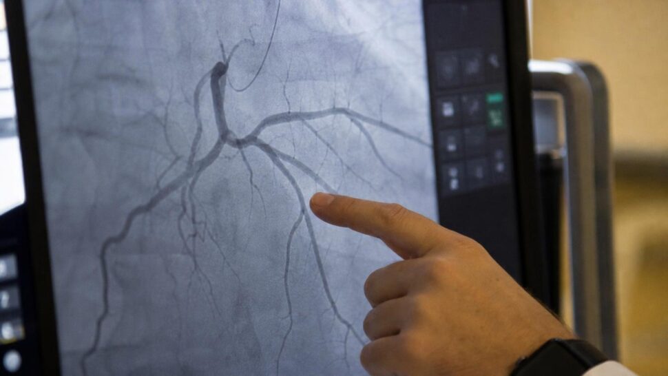 Los cardiólogos son categóricos con el aceite de oliva: esto es lo que hace en las arterias