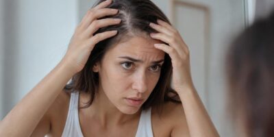 Los médicos explican la relación entre el estrés y la caída del pelo