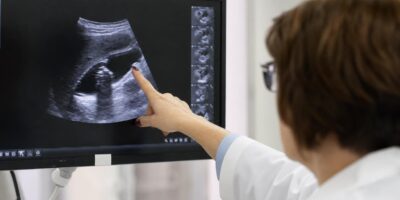 Los médicos explican las piedras en la vesícula: las señales que casi nadie relaciona