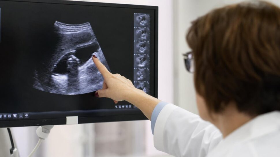 Los médicos explican las piedras en la vesícula: las señales que casi nadie relaciona