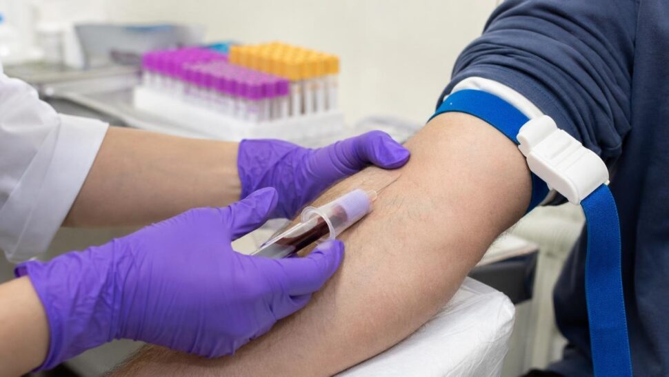 Qué significa de verdad tu nivel de ácido úrico en el análisis de sangre