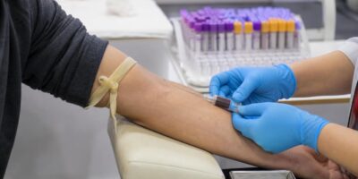 Qué significa de verdad tu nivel de colesterol en el análisis de sangre