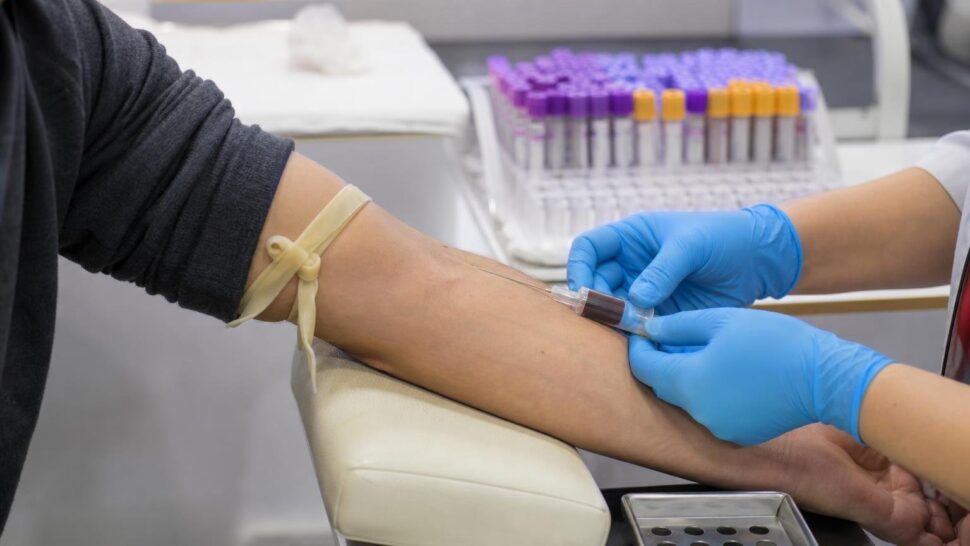 Qué significa de verdad tu nivel de colesterol en el análisis de sangre