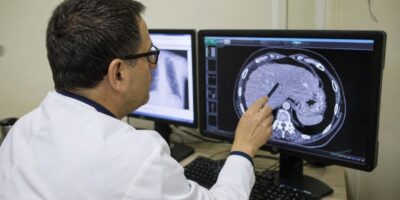 Un hepatólogo avisa: cada vez ve más cirrosis en personas que nunca beben alcohol