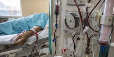 Un nefrólogo avisa: cada vez ve más riñones dañados en personas que toman analgésicos cada semana