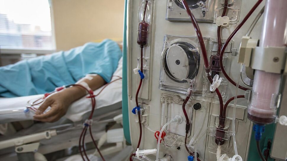Un nefrólogo avisa: cada vez ve más riñones dañados en personas que toman analgésicos cada semana