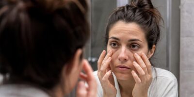 Los médicos explican por qué te salen bolsas debajo de los ojos