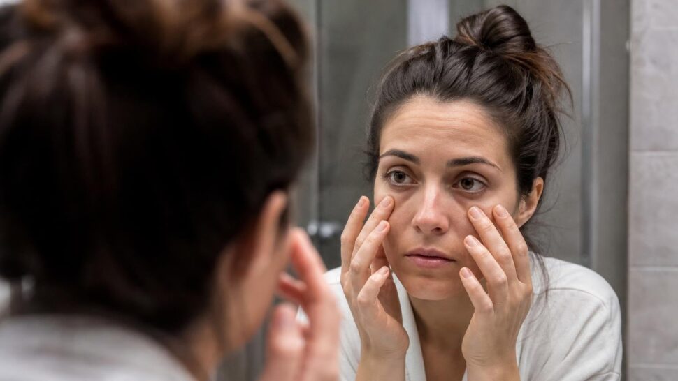 Los médicos explican por qué te salen bolsas debajo de los ojos